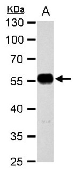 Invitrogen TUBA1A Polyclonal Antibody 100 &mu;L | Buy Online | Invitrogen&trade; | Fisher Scientific