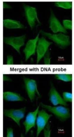 Invitrogen FGD4 Polyclonal Antibody 100 &mu;L | Buy Online | Invitrogen&trade; | Fisher Scientific