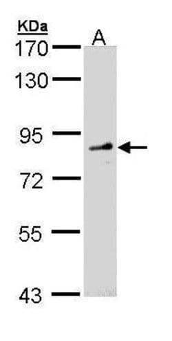 Invitrogen FGD4 Polyclonal Antibody 100 &mu;L | Buy Online | Invitrogen&trade; | Fisher Scientific