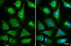 Invitrogen Fumarase Polyclonal Antibody 100 &mu;L | Buy Online | Invitrogen&trade; | Fisher Scientific