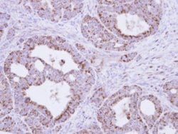 Invitrogen Fumarase Polyclonal Antibody 100 &mu;L | Buy Online | Invitrogen&trade; | Fisher Scientific