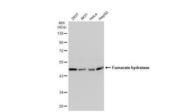 Invitrogen Fumarase Polyclonal Antibody 100 &mu;L | Buy Online | Invitrogen&trade; | Fisher Scientific