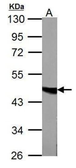 Invitrogen Fumarase Polyclonal Antibody 100 &mu;L | Buy Online | Invitrogen&trade; | Fisher Scientific