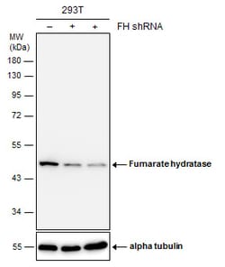 Invitrogen Fumarase Polyclonal Antibody 100 &mu;L | Buy Online | Invitrogen&trade; | Fisher Scientific