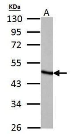 Invitrogen Fumarase Polyclonal Antibody 100 &mu;L | Buy Online | Invitrogen&trade; | Fisher Scientific
