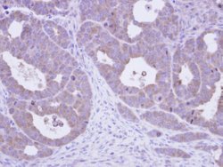Invitrogen TCP-1 epsilon Polyclonal Antibody 100 &mu;L; Unconjugated:Antibodies,