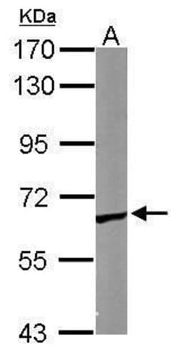 Invitrogen TCP-1 epsilon Polyclonal Antibody 100 &mu;L; Unconjugated:Antibodies,