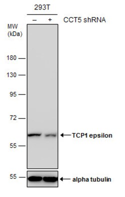 Invitrogen TCP-1 epsilon Polyclonal Antibody 100 &mu;L; Unconjugated:Antibodies,