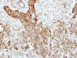 Invitrogen PNLIP Polyclonal Antibody 100 &mu;L; Unconjugated:Antibodies,