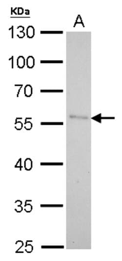 Invitrogen PNLIP Polyclonal Antibody 100 &mu;L; Unconjugated:Antibodies,