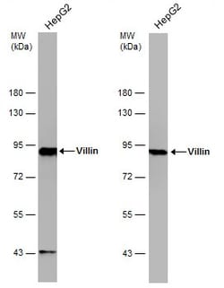 Invitrogen Villin Polyclonal Antibody 100 &mu;L | Buy Online | Invitrogen&trade; | Fisher Scientific