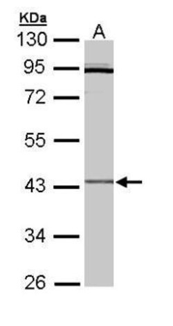 Invitrogen CRLF1 Polyclonal Antibody 100 μL; Unconjugated:Antibodies,
