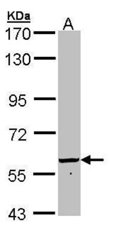 Invitrogen Golgi protein 58k Polyclonal Antibody 100 &mu;L | Buy Online | Invitrogen&trade; | Fisher Scientific