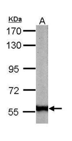 Invitrogen Golgi protein 58k Polyclonal Antibody 100 &mu;L | Buy Online | Invitrogen&trade; | Fisher Scientific