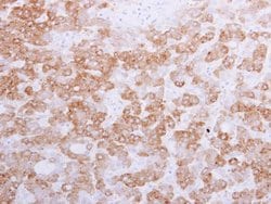 Invitrogen Golgi protein 58k Polyclonal Antibody 100 &mu;L | Buy Online | Invitrogen&trade; | Fisher Scientific