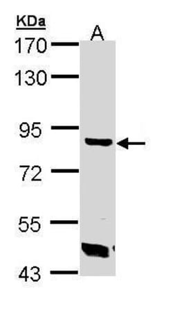 Invitrogen TREH Polyclonal Antibody 100 &mu;L; Unconjugated:Antibodies,