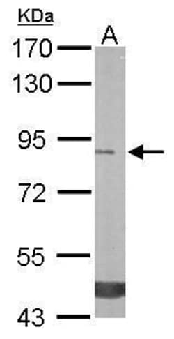Invitrogen TREH Polyclonal Antibody 100 &mu;L; Unconjugated:Antibodies,