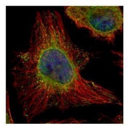 Invitrogen EPHX1 Polyclonal Antibody 100 &mu;L; Unconjugated:Antibodies,