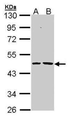 Invitrogen EPHX1 Polyclonal Antibody 100 &mu;L; Unconjugated:Antibodies,