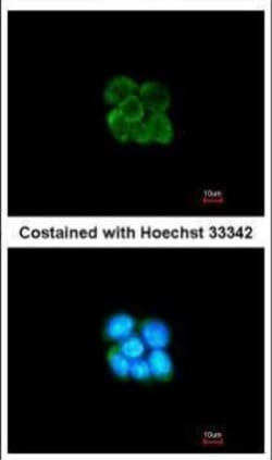 Invitrogen SERPINF2 Polyclonal Antibody 100 &mu;L; Unconjugated:Antibodies,