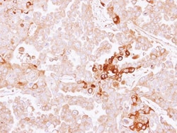 Invitrogen SERPINF2 Polyclonal Antibody 100 &mu;L; Unconjugated:Antibodies,