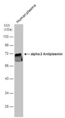 Invitrogen SERPINF2 Polyclonal Antibody 100 &mu;L; Unconjugated:Antibodies,