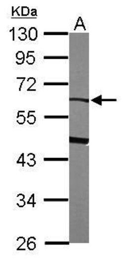 Invitrogen SERPINF2 Polyclonal Antibody 100 &mu;L; Unconjugated:Antibodies,