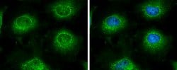 Invitrogen LARS2 Polyclonal Antibody 100 &mu;L; Unconjugated:Antibodies,