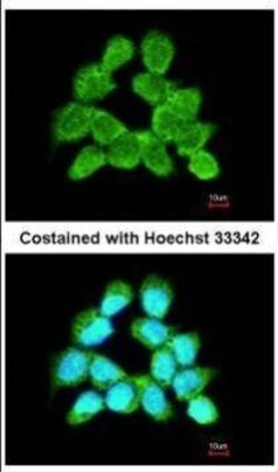 Invitrogen LARS2 Polyclonal Antibody 100 &mu;L; Unconjugated:Antibodies,