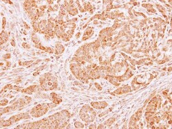 Invitrogen LARS2 Polyclonal Antibody 100 &mu;L; Unconjugated:Antibodies,