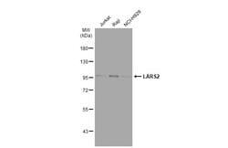 Invitrogen LARS2 Polyclonal Antibody 100 &mu;L; Unconjugated:Antibodies,