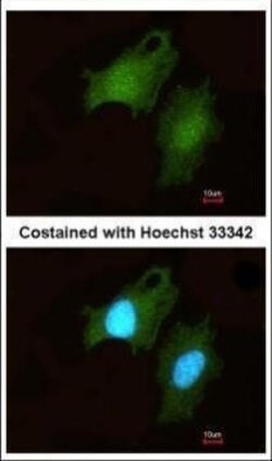 Invitrogen DIP2B Polyclonal Antibody 100 &mu;L; Unconjugated:Antibodies,