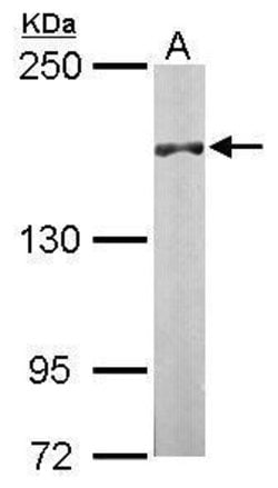 Invitrogen DIP2B Polyclonal Antibody 100 &mu;L; Unconjugated:Antibodies,