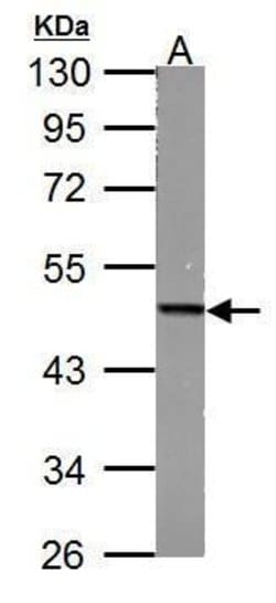 Invitrogen Fumarase Polyclonal Antibody 100 &mu;L | Buy Online | Invitrogen&trade; | Fisher Scientific