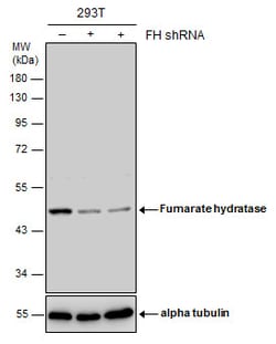 Invitrogen Fumarase Polyclonal Antibody 100 &mu;L | Buy Online | Invitrogen&trade; | Fisher Scientific