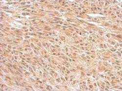 Invitrogen OGT Polyclonal Antibody 100 &mu;L; Unconjugated:Antibodies,