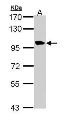 Invitrogen TMEM67 Polyclonal Antibody 100 &mu;L; Unconjugated:Antibodies,