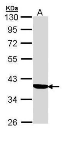 Invitrogen SERPINA6 Polyclonal Antibody 100 μL; Unconjugated:Antibodies,