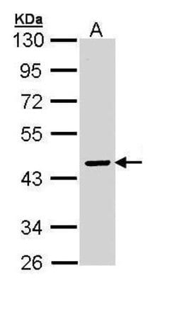 Invitrogen SERPINA10 Polyclonal Antibody 100 &mu;L; Unconjugated:Antibodies,