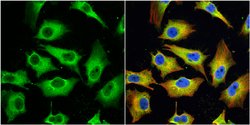 Invitrogen MX1 Polyclonal Antibody 100 &mu;L; Unconjugated:Antibodies,