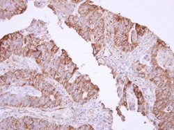 Invitrogen MX1 Polyclonal Antibody 100 &mu;L; Unconjugated:Antibodies,