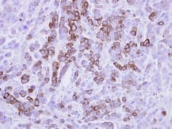 Invitrogen MX1 Polyclonal Antibody 100 &mu;L; Unconjugated:Antibodies,