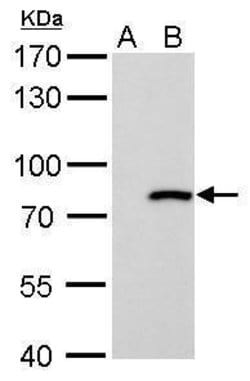 Invitrogen MX1 Polyclonal Antibody 100 &mu;L; Unconjugated:Antibodies,