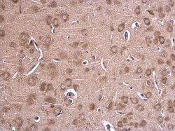 Invitrogen&trade;&nbsp;GLDC Polyclonal Antibody