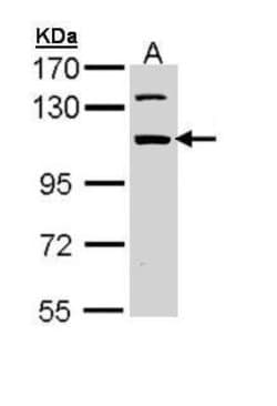 Invitrogen RBM28 Polyclonal Antibody 100 &mu;L; Unconjugated:Antibodies,