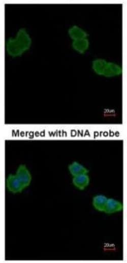 Invitrogen Aminoacylase Polyclonal Antibody 100 &mu;L; Unconjugated:Antibodies,