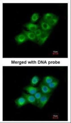 Invitrogen Factor XIII A Polyclonal Antibody 100 &mu;L; Unconjugated:Antikörper