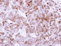 Invitrogen Factor XIII A Polyclonal Antibody 100 &mu;L; Unconjugated:Antikörper