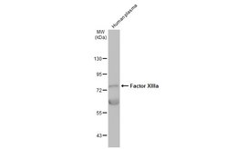 Invitrogen Factor XIII A Polyclonal Antibody 100 &mu;L; Unconjugated:Antikörper