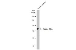 Invitrogen Factor XIII A Polyclonal Antibody 100 &mu;L; Unconjugated:Antikörper